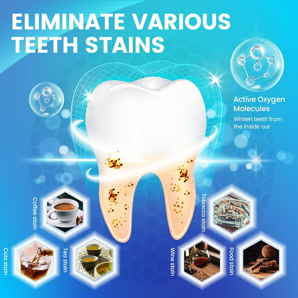 Teeth Whitening Strips, Xpreen Professional White Strips Teeth Whitener for Tooth Whitening, 28Pcs