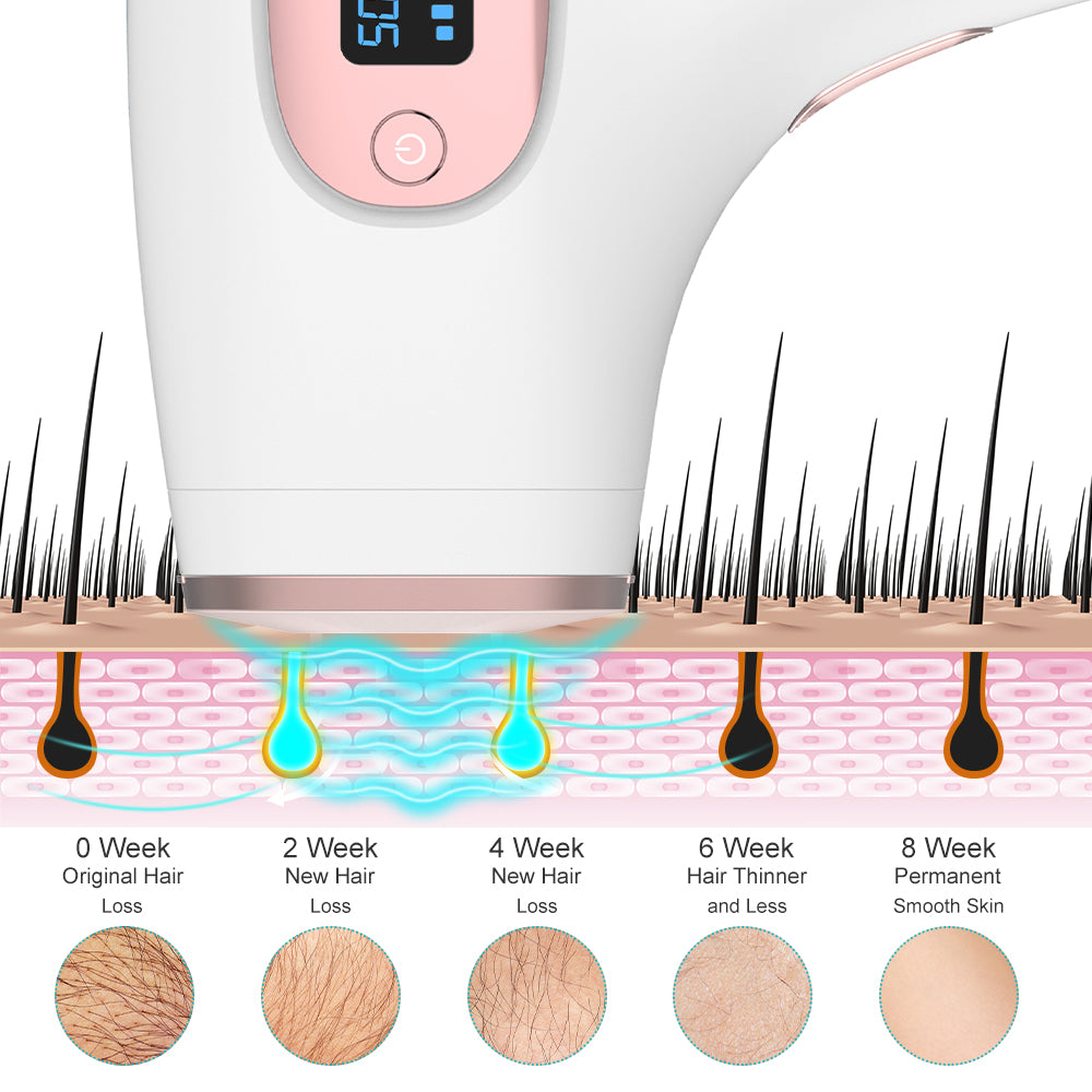 Laser Hair Removal for Women