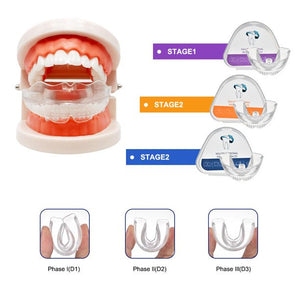 Mouth Guard for Grinding Teeth, 3 Stages Dental Guard, Comfortable Custom Mold for Clenching, Bruxism, Whitening Tray & Sports Guard(3 Pack)