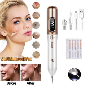 Mole Remover Pen,Skin Tag Remover Dark Spot Remover Freckle Tattoo Wart Mole Removal Tool,9 Levels Adjustable/LCD Screen