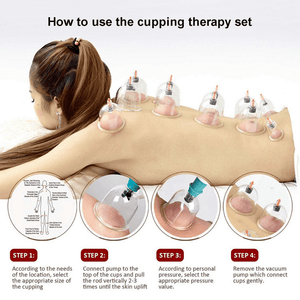 Cupping Set, 24 Cups Professional Chinese Acupoint Cupping Therapy Sets, Hijama Cupping Set with Pump Vacuum Suction Cups for Body Cellulite Cupping Massage Back Pain Relief